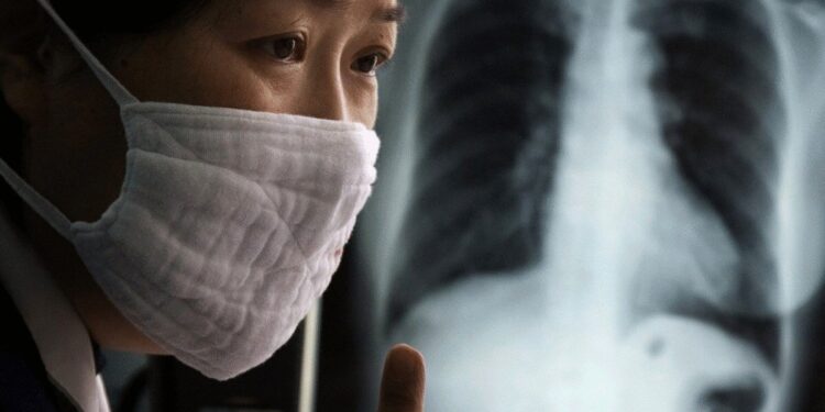 Ауруханада істеген мейірбикеден туберкулез анықталған