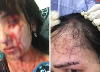 «Телефонмен ұрып, басымды жарды»: Атыраулық әйел депутат күйеуінен 12 жыл зорлық көргенін айтты