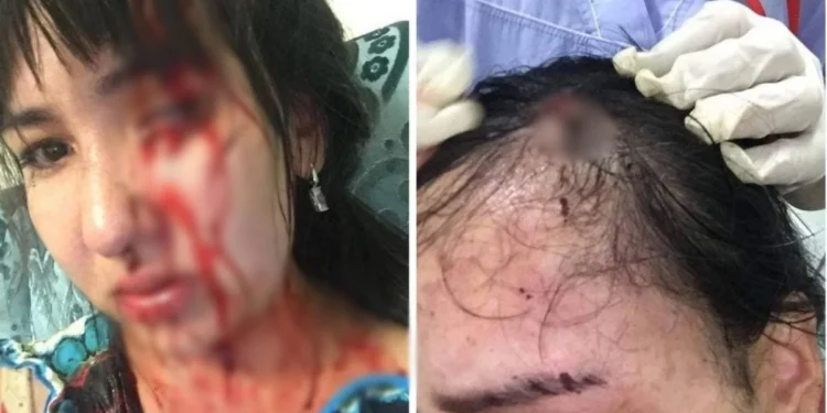 «Телефонмен ұрып, басымды жарды»: Атыраулық әйел депутат күйеуінен 12 жыл зорлық көргенін айтты