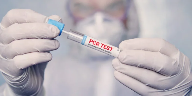 Елімізде В және С вирустық гепатиттерін анықтауға скрининг өткізіледі