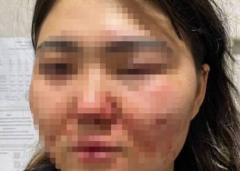 «Мені мүгедек қылды, бірақ әлі ешкім жазаланған жоқ»: Алматылық әйел полицияның әрекетсіздігіне шағымданды