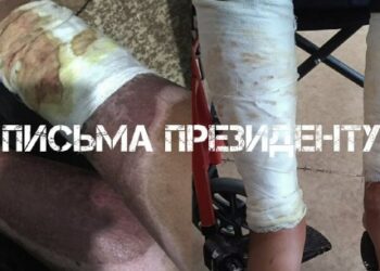 Жасөспірімнің киіміне сіріңке лақтырып, өртеп жіберген: Іс сотқа жетпей отыр