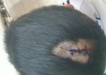 «Бас терісі жарылып кетті»: Қостанайдағы спорт мектебінде 6 жасар баланың басына шам құлап түсті